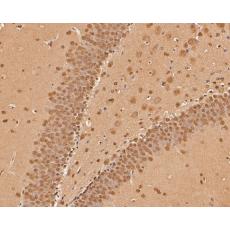 Anti-CPEB1 antibody