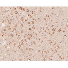 Anti-P2X3 antibody