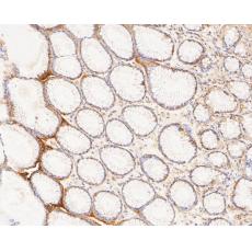 Anti-Claudin18.2 antibody