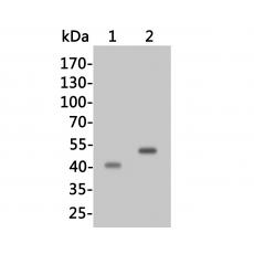 Anti-HPD antibody
