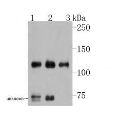 Anti-TAG1 antibody