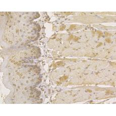 Anti-Plakophilin 3 antibody
