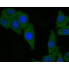 Anti-GFPT1 antibody