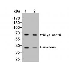 Anti-Glypican 5 antibody
