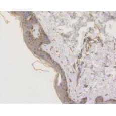 Anti-S100A2 antibody