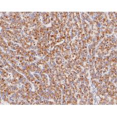 Anti-ME2 antibody