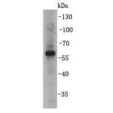 Anti-BMPR1B antibody
