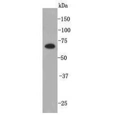 Anti-PRDM14 antibody