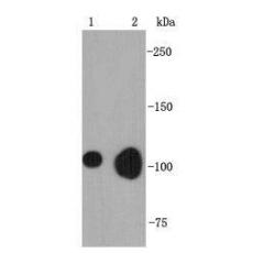 Anti-BNC1 antibody