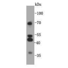 Anti-GPR132 antibody