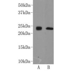 Anti-THY-1 antibody