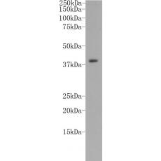 Anti-CD14 antibody