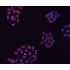 Anti-β-tubulin antibody