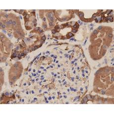 Anti-EP-CAM antibody
