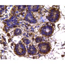 Anti-Isocitrate dehydrogenase/IDH1 antibody