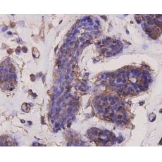 Anti-AKT1 antibody