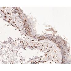 Anti-ERK2 antibody