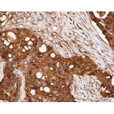 Anti-ERK2 antibody