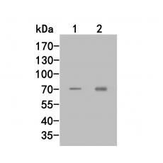 Anti-RARS antibody