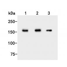Anti-UGGT1 antibody