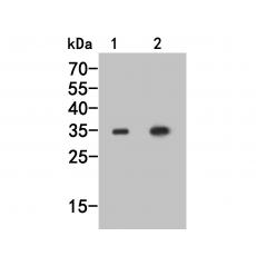 Anti-MEMO1 antibody