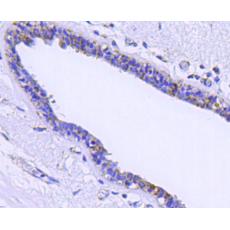 Anti-Sequestosome-1 antibody