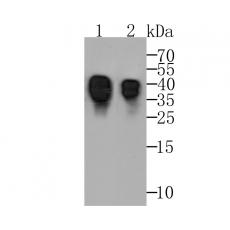 Anti-ORM1 antibody
