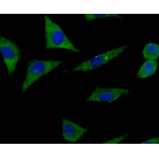 Anti-PARP1 antibody