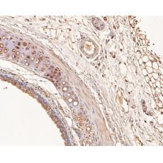 Anti-RUVB2 antibody