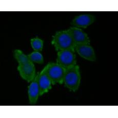 Anti-RUVB2 antibody