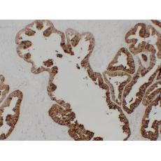 Anti-Prostatic Acid Phosphatase(PSAP) antibody [PT1651]