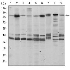 Anti-FUK antibody [E2-C3]