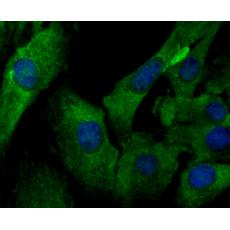 Anti-IL6 antibody [11-D4]