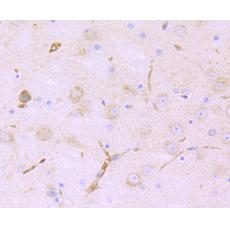 Anti-Lnpk antibody [11-1]