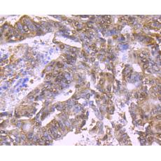 Anti-Bmi1 antibody [A11-C11]