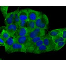 Anti-Cardiac Troponin T antibody [3-G6]