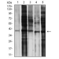Anti-CD195 antibody [6G11D1]