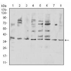 Anti-TNFSF11 antibody [8A7B9]