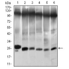 Anti-TWIST1 antibody [E6-F4]