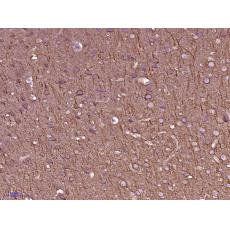 Anti-beta I Tubulin antibody [5F7]