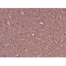 Anti-beta I Tubulin antibody [5F7]