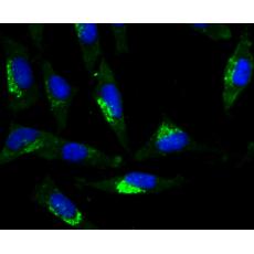 Anti-Glucagon antibody [5F1]