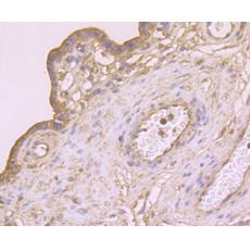 Anti-CTHRC1 antibody [5H1]