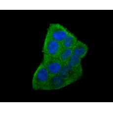 Anti-IL6 antibody [1-6]