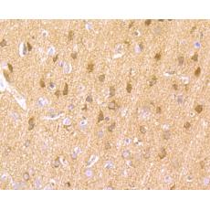 Anti-LNP antibody [7-3]