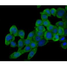Anti-PI3-kinase p85 subunit alpha antibody [L3-D6]