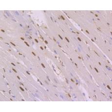 Anti-NFIB NF1B2 antibody [1H2]