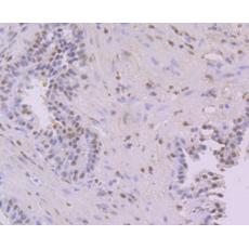 Anti-NFIB NF1B2 antibody [1H4]