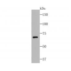 Anti-CUB domain-containing protein 1 antibody [B2-E6]