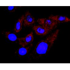 Anti-TSH antibody [AH21-10]